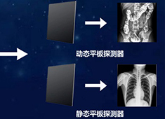 雙板DR與單板DR的區別：不止是多一個平板