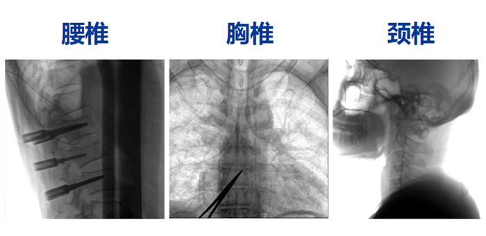 骨科手術(shù)機(jī)器人能做什么手術(shù)